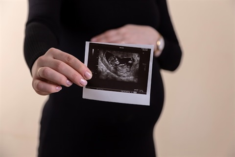 sonogram